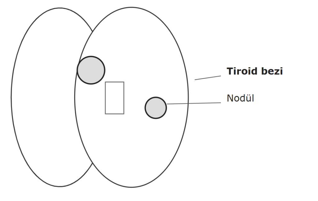 Tiroid Nodülleri: Bilmeniz Gerekenler